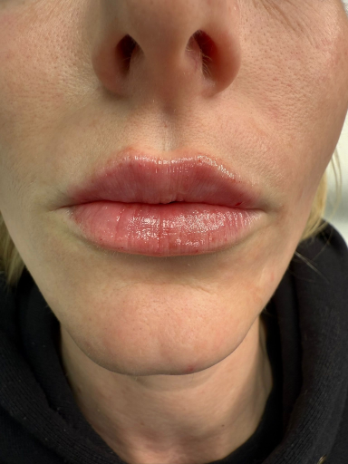 Aesthetics Banbury House Of Coco 2 1791188518 Medium